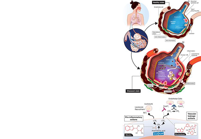 Novateur Ventures Explores New Strategy to Reduce the Hyperinflammatory Response Caused by COVID-19